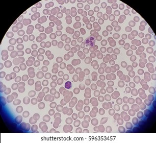 Human Blood Smear Normal Red Blood Stock Photo (Edit Now) 596353457