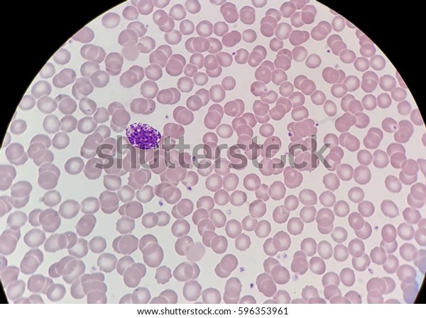 Human Blood Smear Normal Red Blood Stock Photo (Edit Now) 596353961