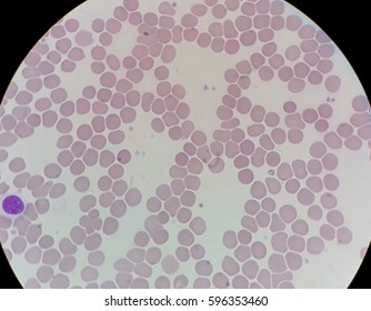 Human Blood Smear Red Blood Cells Stock Photo 596353460 