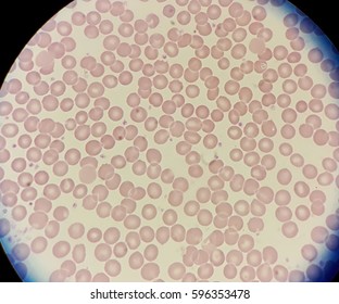 Human Blood Smear Red Blood Cells Stock Photo 596353478 