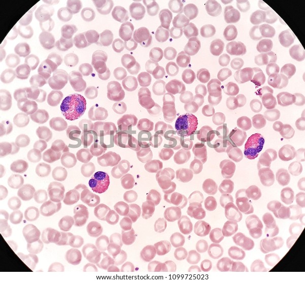 Human Blood Smear Under 100x Light Stock Photo 1099725023 | Shutterstock