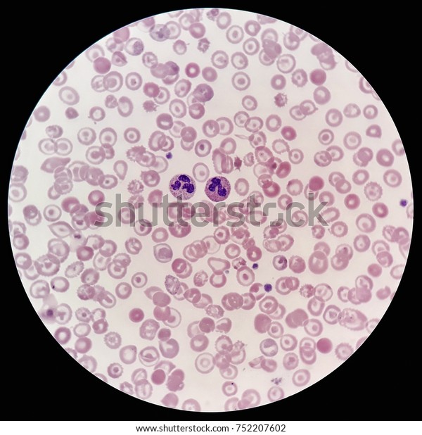 Human Blood Smear Under 100x Light Stock Photo (Edit Now) 752207602