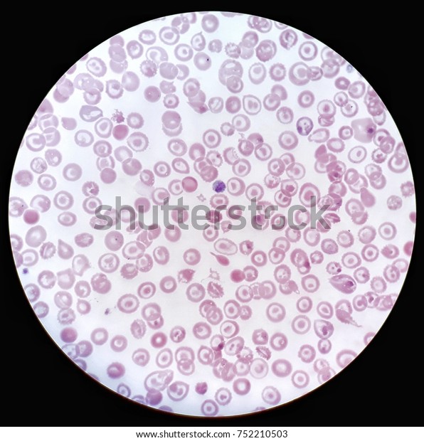 Human Blood Smear Under 100x Light Stock Photo (Edit Now) 752210503