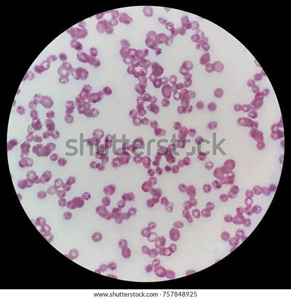 Human Blood Smear Under 100x Light Stock Photo 757848925 | Shutterstock