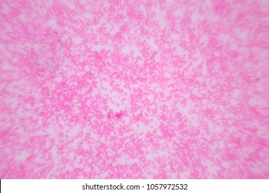 73 Blood vessels on scrotum Images, Stock Photos & Vectors | Shutterstock