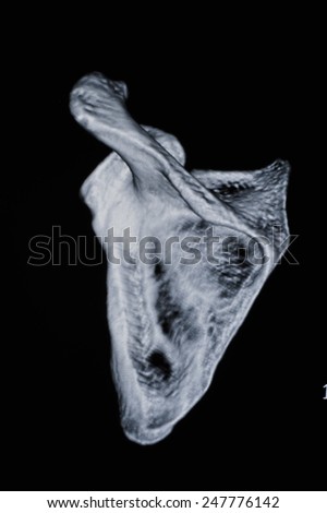Human bone CT images