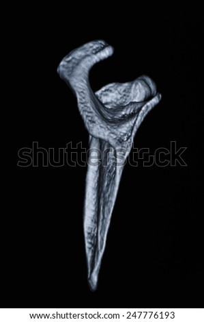Human bone CT images