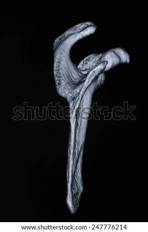 Human bone CT images