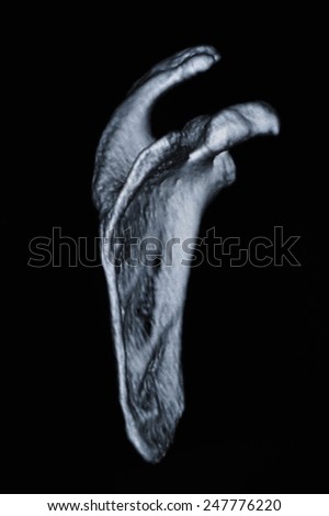 Human bone CT images