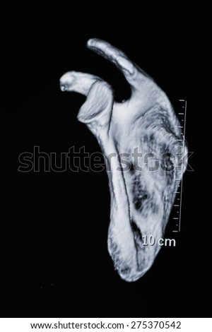 Human bone CT images