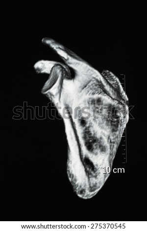 Human bone CT images