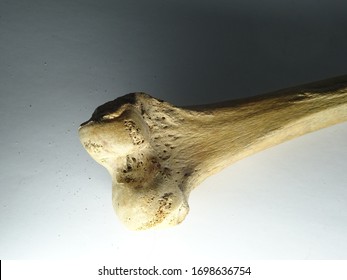 Human Bone Joint (right Tibia)