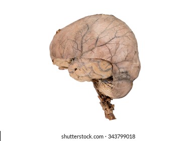 Human Brain With Dura Mater