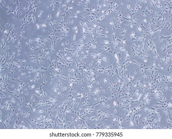 Human Brain Endothelial Cells (hCMEC/D3 cells) were captured by Light Microscope (40x)