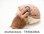 Human brain model and doctor