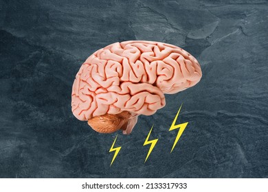 Human Brain Model On Dark Gray Background, Concept Of Level Of Mind, Intellectual Achievements, Possibility Of People's Intelligence, Development Of Mental Abilities