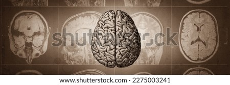 The human brain on the background of a computed tomography image. Medical and scientific background. Brain research.