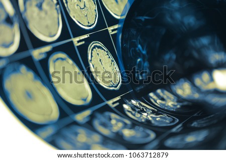 Human brain scan testing film folded in a roll, medical background with space for your design.