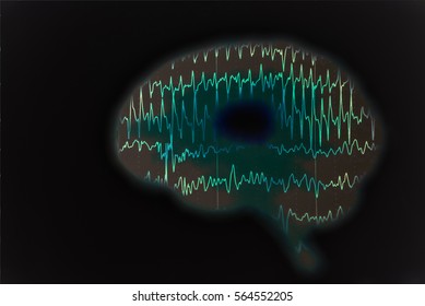 Human Brain Wave On Electroencephalogram, EEG For Epilepsy And Abnormal Seizure