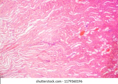 Human Hair Microscope Images, Stock Photos & Vectors | Shutterstock