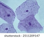 Human cheek cells stained with methylene blue, seen with a light microscope.