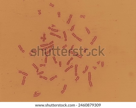 Human chromosome under microscope stained with giemsa
