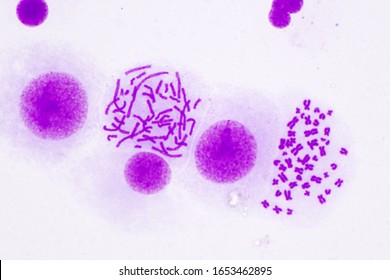 Human chromosomes under the microscope