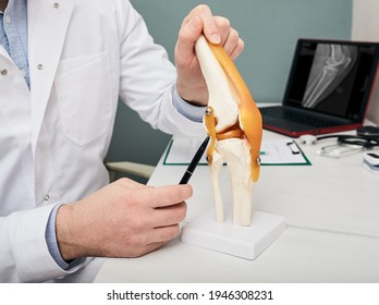Human cruciate ligament injury treatment concept. Orthopedist showing to cruciate ligament in a knee-joint medical teaching model, close-up