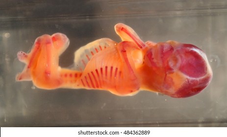 Human Embryo