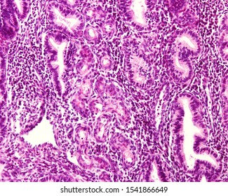 Human Endometrium. Secretory Phase Of The Uterine Cycle. A Spiral Artery Appears Sectioned Many Times Due To Its Spiral Course.