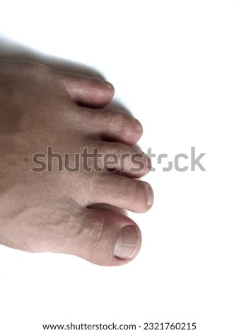 A human endpoint with five toes aligned in a short-looking toe.