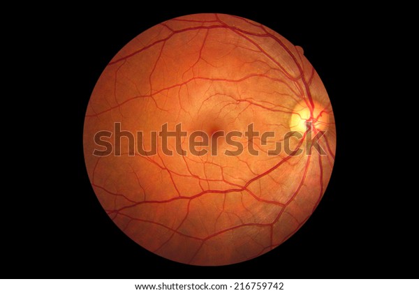 Human eye anatomy taking images with Mydriatic\
Retinal cameras