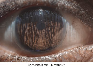 Human Eye. Close Up Of Asian Human Eye Under Bright Sun Light. Brown Eye Close Up. 