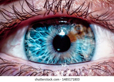 Human Eye Close-up. Heterochromia Iridum