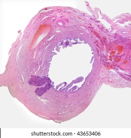 Human Fallopian Tube Cross Section.  Magnification 40X