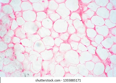 Human fat body tissue under microscope view for physiology education.