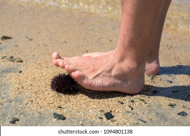 Human Feet On Sea Urchin At The Beach