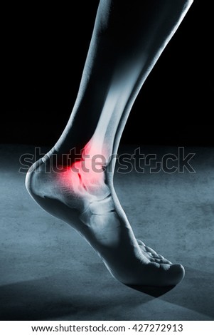 Human foot ankle and leg in x-ray, on gray background. The foot ankle is highlighted by red colour.
