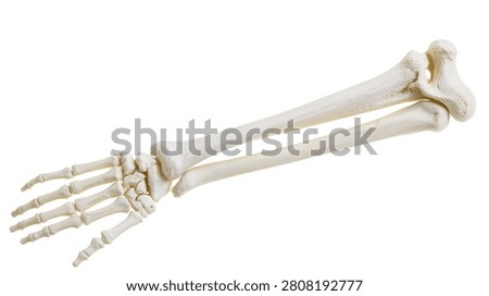 Human forearm radius and ulna bones with hand skeleton model