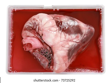 A Human Heart Lays In A Dish Ready For Transplant Into A Human Body