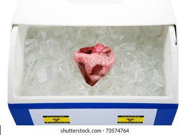 A Human Heart Lays On A Bed Of Ice In An Ice Chest Ready For Transplant From An Organ Donor. Isolated On White With Room For Your Text