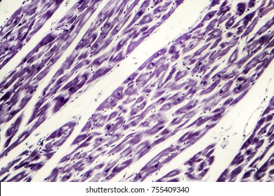 Human Heart Muscle, Light Micrograph. Striated Cardiac Muscle Cells, Or Myocytes