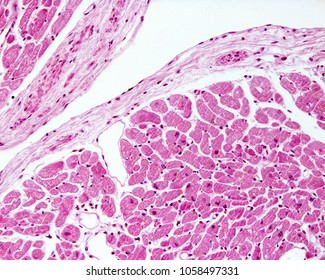 Human Heart Ventricle Endocardium. It Is The Innermost Layer Of The Heart Wall, Lined By A Endothelium Supported On A Connective Tissue Layer. 