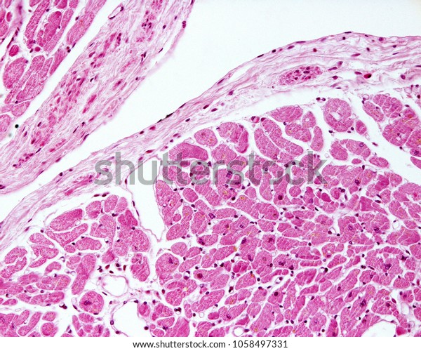 Human heart ventricle endocardium. It is the\
innermost layer of the heart wall, lined by a endothelium supported\
on a connective tissue layer.\
