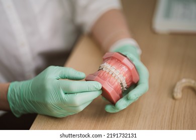 Human Jaw Or Teeth Orthodontic Dental Model With Dental Braces Implants In The Hands Of An Orthodontist. Dental And Orthodontic Office Presentation Tool 