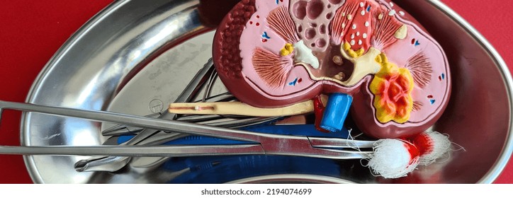 Human Kidney Model With Adrenal Gland With Scalpel And Clamps. Kidney Surgery