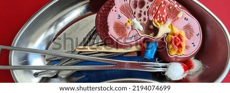 Human kidney model with adrenal gland with scalpel and clamps. Kidney surgery