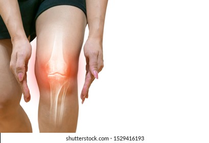 Human leg Osteoarthritis inflammation Of bone joints