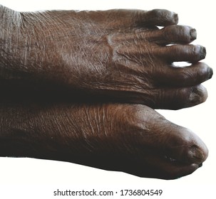 Human Legs Wither Old Age On Stock Photo 1736804549 | Shutterstock