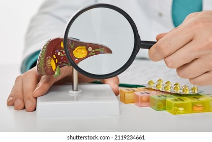 Human liver disease, diagnosis and liver treatment. Doctor showing liver anatomical model for treatment hepatitis, cirrhosis and cancer
